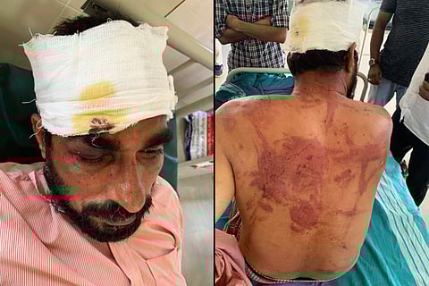 Man with injuries on his body