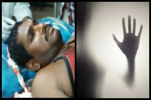 Andhra journalist thrashed with iron rods for exposing alleged sand mining