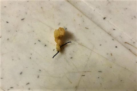 Hyderabad hotel fined Rs 5,000 after customer finds iron wire in biryani