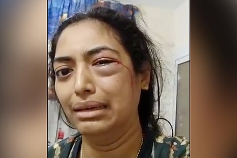 'My husband may harm me again': Bengaluru MBA grad stuck in UAE seeks India’s help