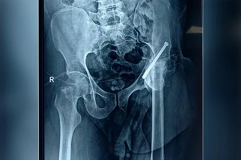An X-ray of Kasim