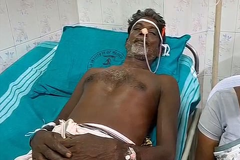 Video: Live fish gets stuck in Kerala man's throat for an hour, removed after surgery