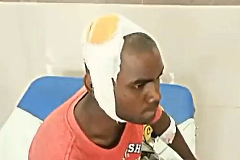 Dalit youth Karduram Nandu, who was tonsured, beaten for inter-caste marriage