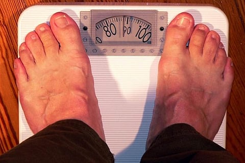 Representative image for obesity