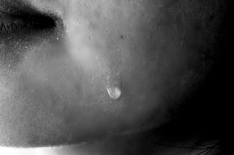 Mysuru minor dies, days after she set herself on fire due to alleged harassment