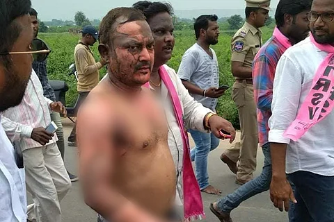 TRS worker who self-immolated for MLA dies, even as leader and KCR patch up