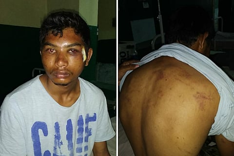 Dalit man thrashed in Telangana by family of upper caste woman for trying to elope