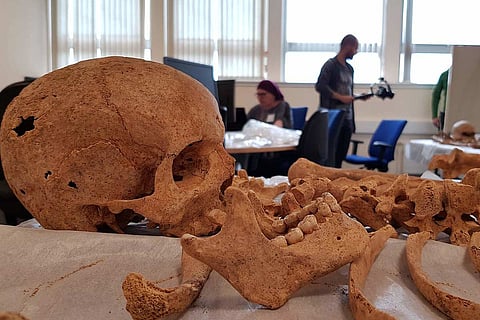 Representational image of a skull and bones