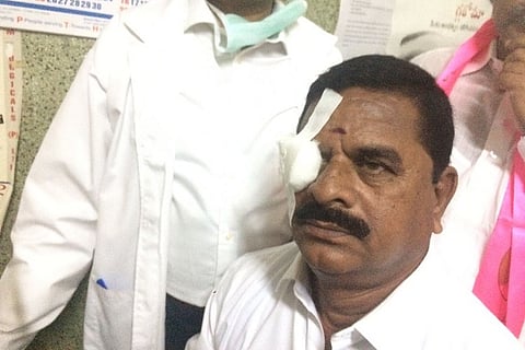 Watch: Cong MLA flings headphone in Telangana Assembly, injures council head’s eye