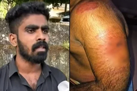 Vignesh custodial torture victim Kerala