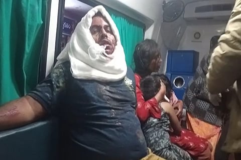 An injured man covering his head with a white cloth to stop the bleeding