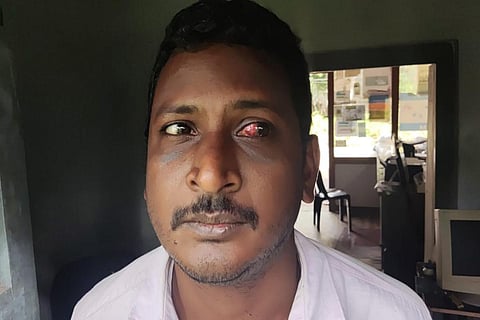 Andhra Dalit activist Chevvukula Venkateswara Rao who was assaulted and arrested allegedly at behest of MLA
