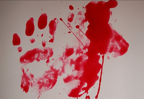 Dogs maul 10-year-old girl to death in Andhra's Srikakulam district