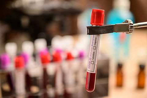 Kerala gets ICMR nod to use plasma therapy for COVID-19, K’taka to follow suit