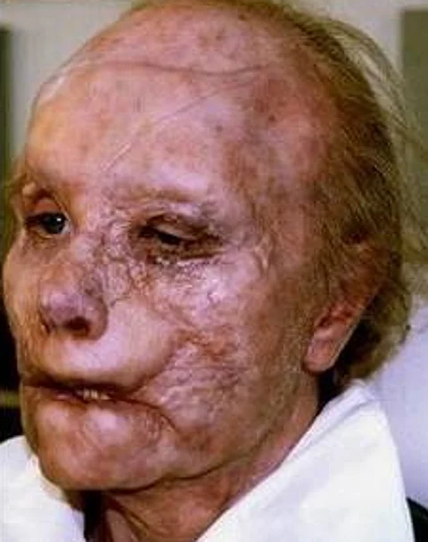 Gary Oldman before and after his make-up for the 2001 movie Hannibal