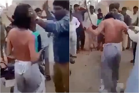 Mentally ill man thrashed by Hyderabad mob on suspicion of being a dacoit