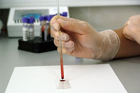 Nipah virus: How Kerala’s ‘contact list’ finds and watches persons who may be at risk