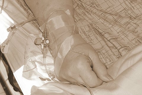 A simple infection could lead to paralysis: Here's what Guillain Barre syndrome can do