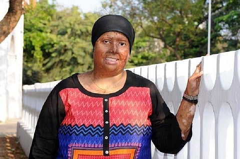 Bengaluru-based acid attack survivor now supports burn victims