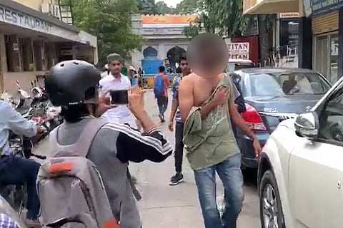 Anti-CAA protests: Bengaluru man dislocates shoulder after cops allegedly manhandle him