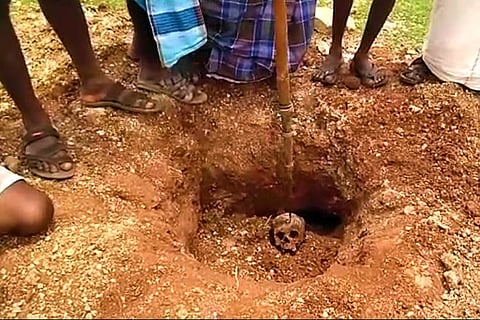 Skulls of leucoderma patients exhumed, burnt to invoke rain in this remote K’taka village