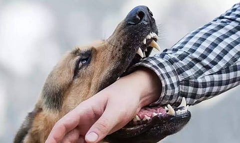 DoH: Bites transmit rabies, not eating meat