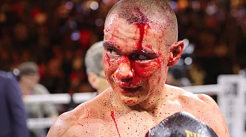Tim Tszyu's super-welterweight title fight is off because of this head wound