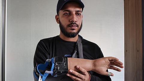 Bangladeshi students who lost their hands during protests to overthrow the government in August have been fitted with robotic replacements