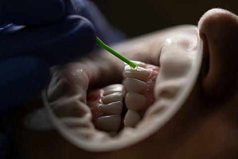 PhilHealth greenlights oral health coverage