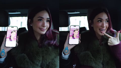 Heart Evangelista reveals that she underwent lip enhancement