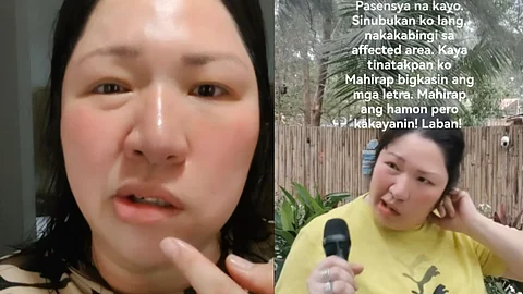 Frenchie Dy shares her struggle with Bell's Palsy for the third time
