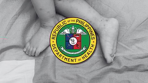 HFMD cases nearly triple; DOH: it's 'not that bad'