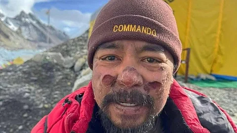 Filipino climber Philipp Santiago wearing a red down jacket and brown beanie labeled "COMMANDO," with visible frostbite marks on his face, standing at Mount Everest Base Camp with a yellow expedition tent and snowy peaks in the background.