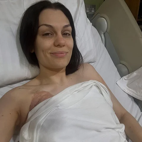 BRITISH singer Jessie J recently underwent surgery after being diagnosed with breast cancer earlier this June.