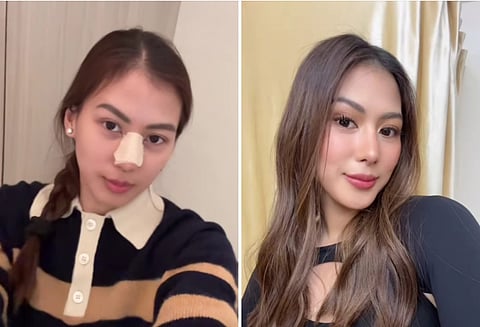 A Major Decision for Actress and Content Creator Alex Gonzaga