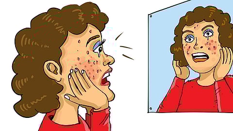 Popping pimples can destroy the skin barrier. If the skin barrier is destroyed, bacteria enters, which can cause further infection.