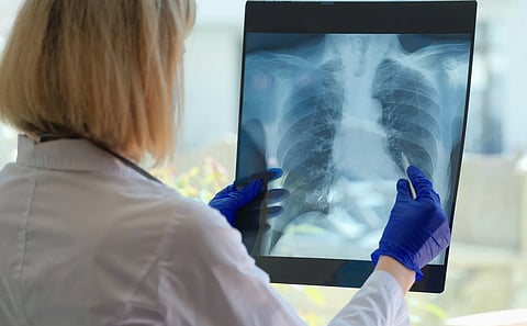 WHO, DoH declare war vs tuberculosis