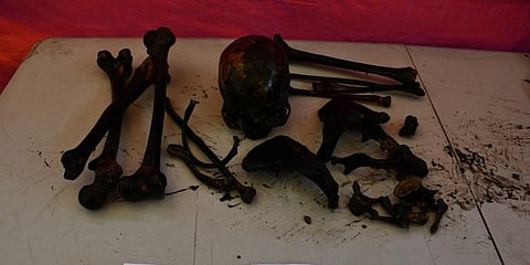 The skeletal remains recovered in Taal