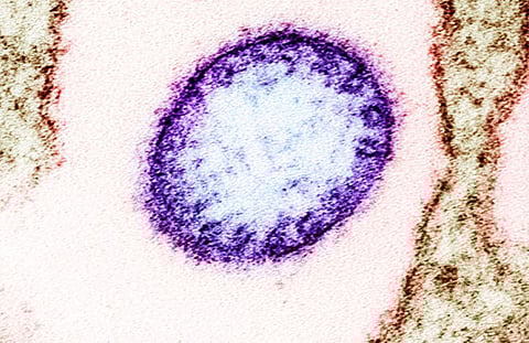 COLORIZED transmission electron micrograph na nagpapakita ng isang particle (purple) ng Nipah virus.