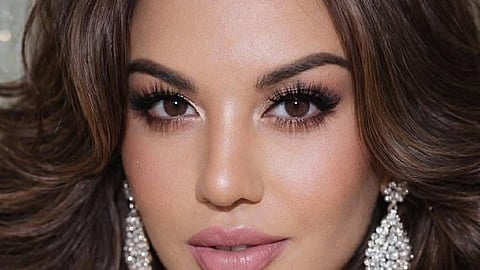 Imelda Schweighart reveals side on pageant issue