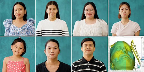 Meet “The First Seven” — patients undergoing advanced treatment through the Belo Scar Project.