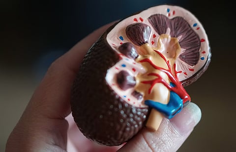 KIDNEY screening also reveals related problems such as diabetes, hypertension and obesity so early detection is key.