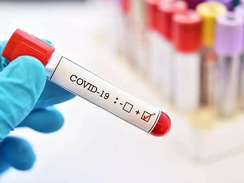 US health secretary tests positive for Covid on Germany trip