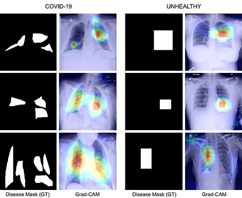 IIT Jodhpur team develops Covid diagnosis technique using chest X-Ray