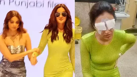 What happened to Jasmine Bhasin, Jasmine Bhasin Eyes, Jasmine Bhasin Eye Injury, Jasmine Bhasin Cornea, Jasmine Bhasin Cornea Injury, All about Jasmine Bhasin Eyes Injury, Jasmine Bhasin Delhi Eye Injury, Jasmine Bhasin Cornea Injury