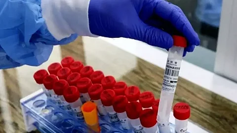 New study explores AI in developing antibiotics with less side-effects