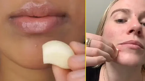 Beauty Influencers Garlic Rubbing Trend