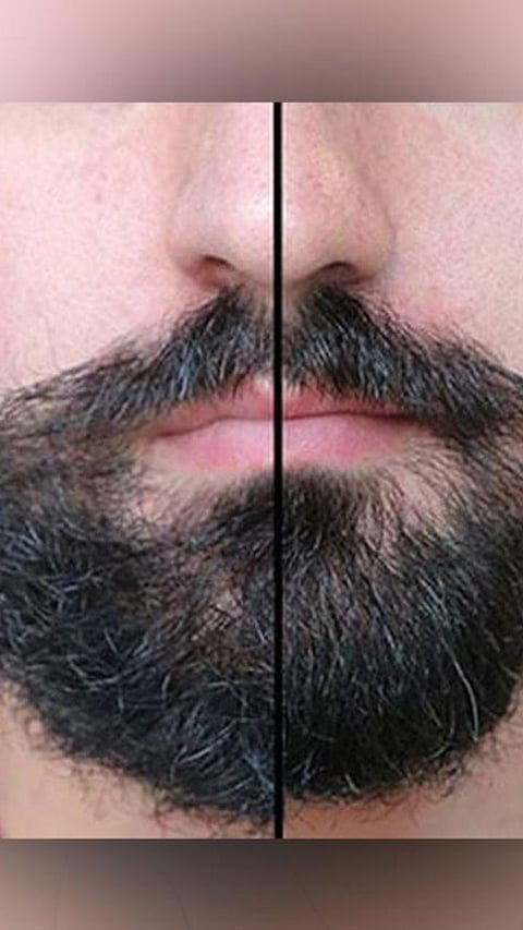 5 big problems while growing a full beard and how to fix it