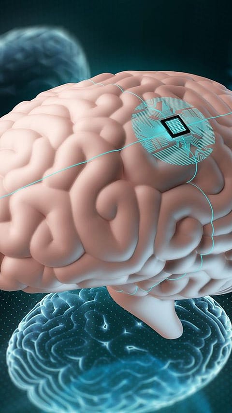 9 revealing facts about Elon Musk’s Neuralink