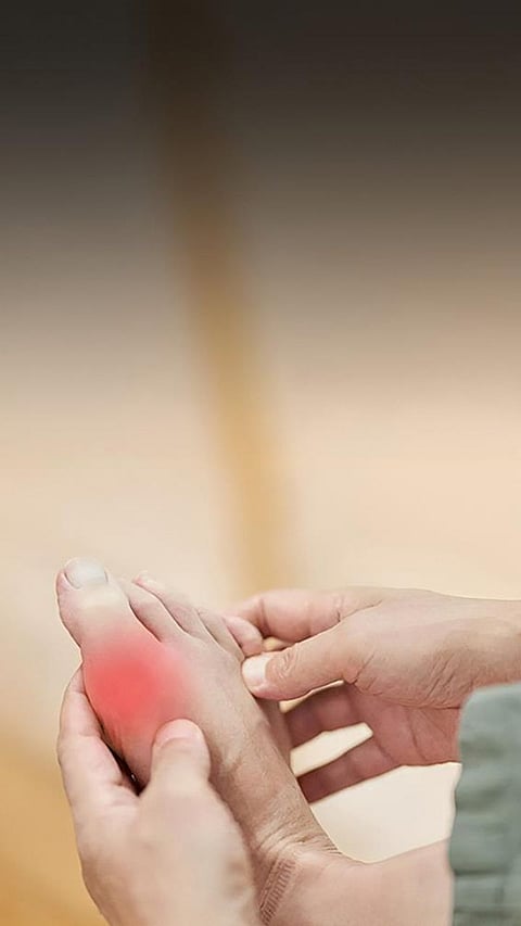 7 Tips to Control your Uric Acid